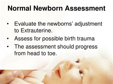 Ppt Newborn Transition Assessment Powerpoint Presentation Free