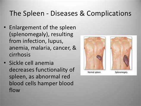 The Spleen