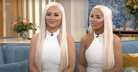 This Morning Twins Stun Viewers With K Cosmetic Procedures