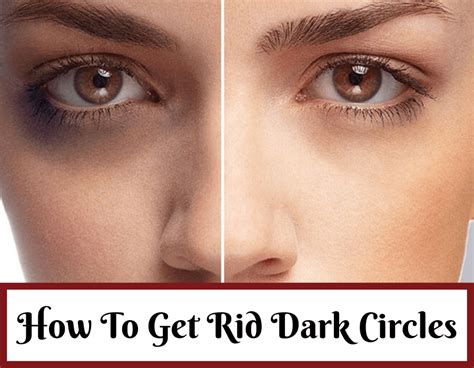 How To Get Rid Of Dark Circles At Home Overnight Trabeauli