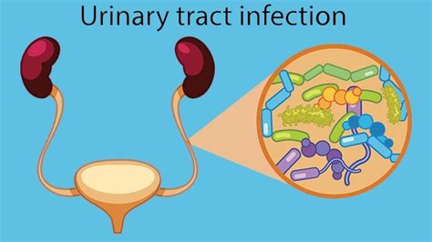 The Connection Between E Coli And Urinary Tract Infections Utis