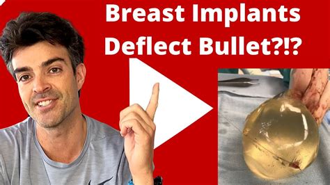 Woman S Breast Implants Deflect Bullet Saving Her Life True Story
