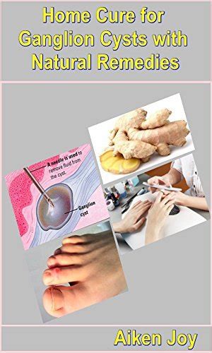 Home Cure For Ganglion Cysts With Natural Remedies By Aiken Joy Goodreads