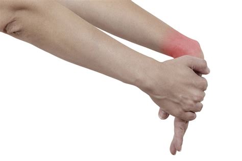 Elbow Tendonitis Exercises - How to Fix and Strengthen ...