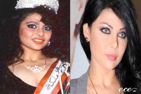 Contact Support Celebrities Plastic Surgery Celebrities Before And