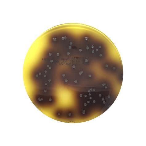Listeria Listeria Monocytogenes Bacteria Photograph By Dr Kari