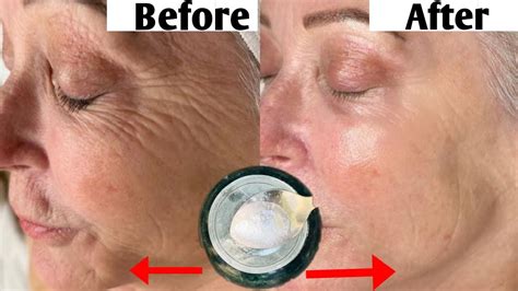 Anti Aging Serum Stronger Than Botox Eliminates Wrinkles And Fine Lines Youtube