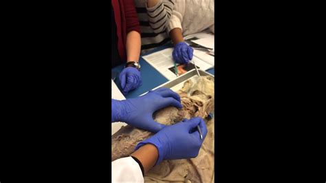 We did not find results for: Cat Dissection: Deep Muscles of Upper Back, Shoulders ...