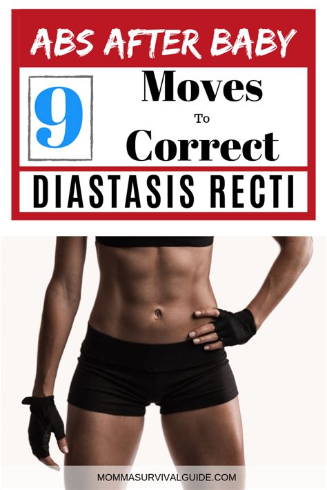 The Best How To Fix Male Diastasis Recti Years Later 2022