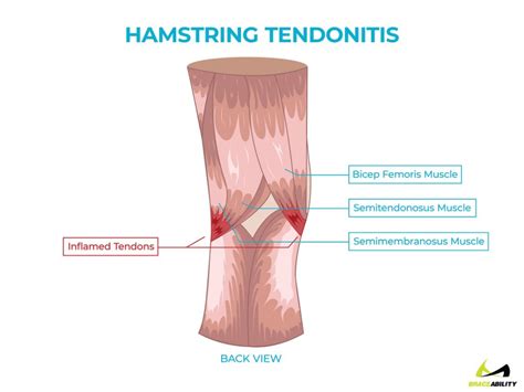 Maybe you would like to learn more about one of these? Pin on Dealing With Knee Pain