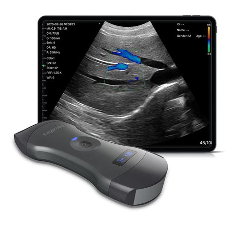 Eagleview Portable Wireless Ultrasound Machine With Linear Convex And