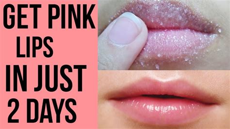 How To Get Pink Lips Naturally At Home Youtube