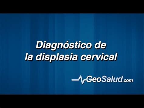 Diagnóstico de la displasia cervical YouTube