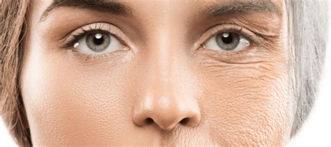 How To Get Rid Of Wrinkles And Fine Lines Landl Skin