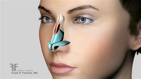 how to remove bumps on nose large nose surgery by dr fechner rhinoplasty animation youtube