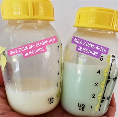 Debate After Mum Shares Photo Of Breast Milk Before And After Her Baby Was Vaccinated Mouths