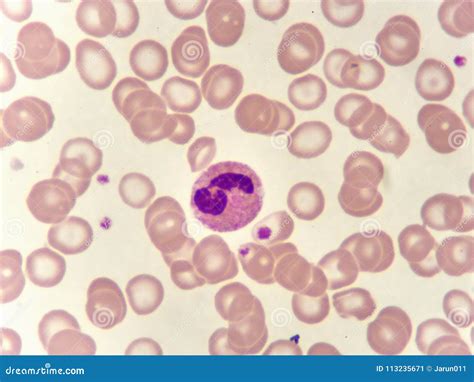 Neutrophil Cell In Blood Smear Stock Image Image Of Monocyte