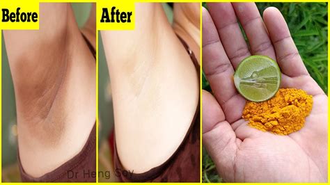 Whiten Dark Underarms Instantly Permanently 100 Works At Home YouTube