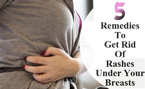 5 Remedies That Can Help You Get Rid Of Rashes Under Your Breasts
