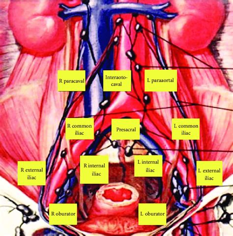 Template Of Extended Lymph Node Dissection During Radical Cystectomy
