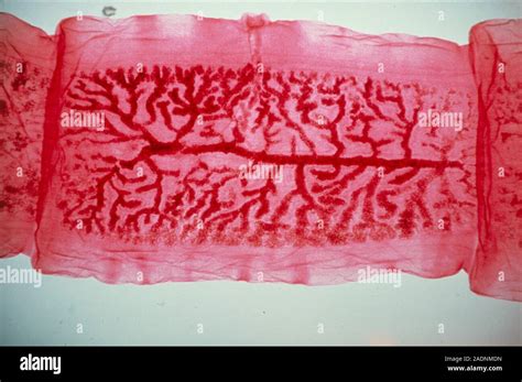 Tapeworm Light Micrograph Of A Unit Proglottid From The Body