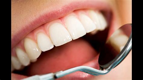 Calcium Deposits On Teeth Teethwalls