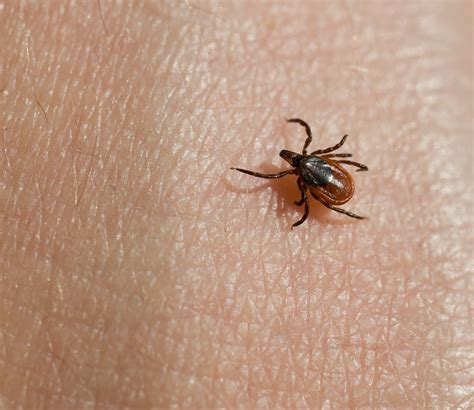 Ticks And Lyme Disease Western Up Health Department