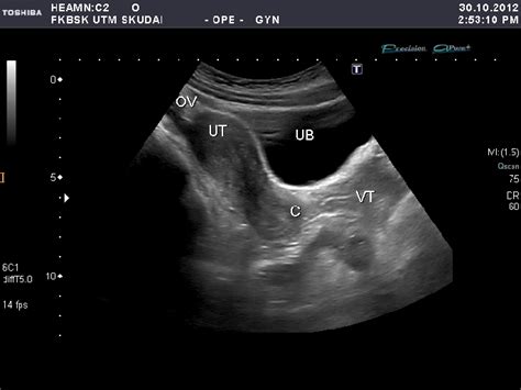 Cervix Ultrasound Image Download Scientific Diagram