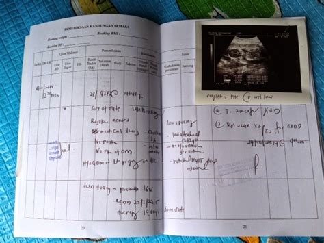 Check spelling or type a new query. Pemeriksaan Ibu Mengandung di Klinik Kerajaan | irrayyan.com