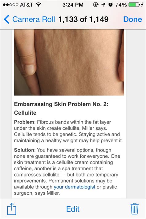 🎀8 Solutions For Embarrassing Skin Problems 🎀😊💆 Musely