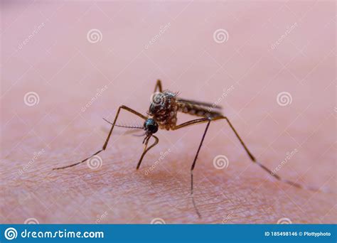 Dangerous Malaria Infected Mosquito Skin Bite Stock Photo Image Of