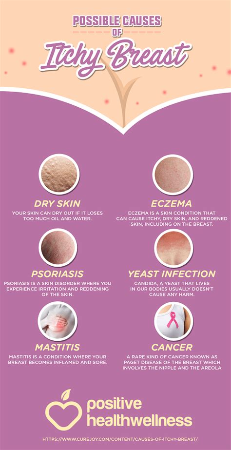 6 Possible Causes Of Itchy Breasts Infographic Positive Health Wellness