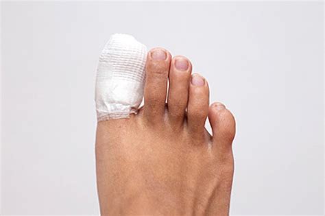 What Are The Symptoms Of A Broken Toe