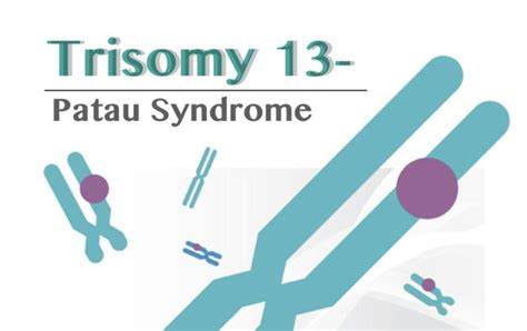 Trisomy 13patau Syndrome Definition Causes Symptoms Life