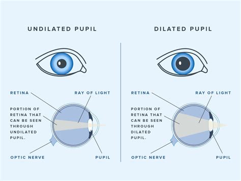 How Long Does Eye Dilation Last Warby Parker