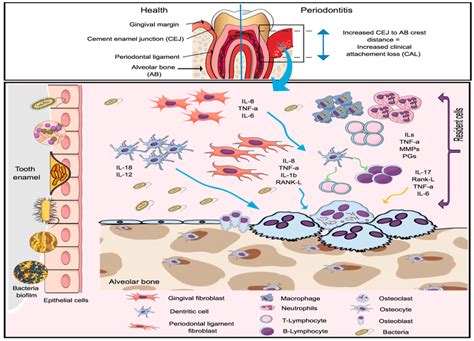 Immune Response In Periodontal Disease Reprinted With Permission From Download Scientific