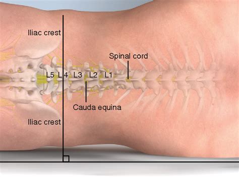 Pdf Spinal Puncture And Cerebrospinal Fluid Examination Semantic