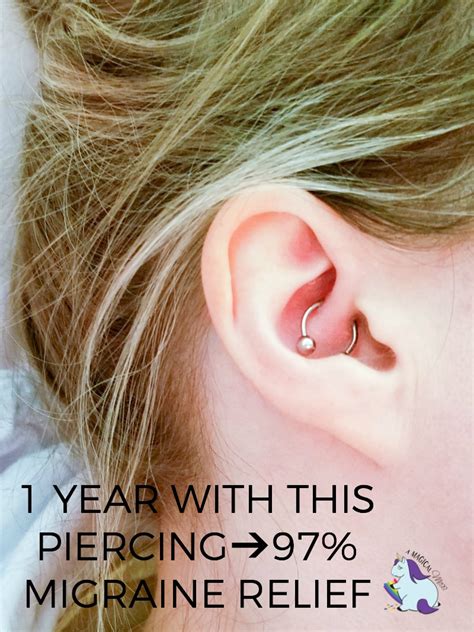 Migraine Piercing 1 Year Results After Daith Piercing For Headaches