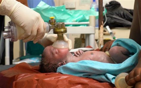 New Video Shows Basic Steps Of Newborn Resuscitation Global Health Media Project