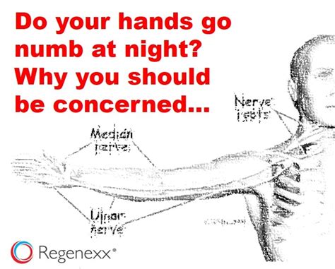 Hands Numb While Sleeping Dont Ignore This Sign Regenexx Blog