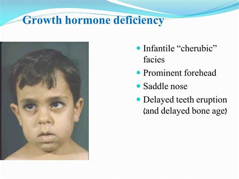 Causes Of Growth Hormone Deficiency Growth Hormone Deficiency Boston