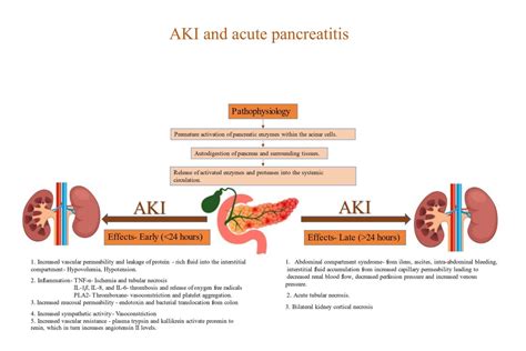 Nephron Power Concept Map Acute Pancreatitis And Aki