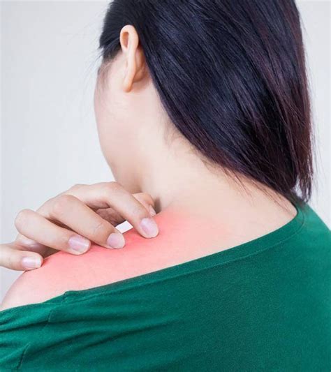 Some people recommend alternatives like olive oil, chamomile oil, and aloe vera as possible treatments for heat rash. 27 Effective Home Remedies For Prickly Heat | Home remedies, Rashes remedies, Hair growth tips