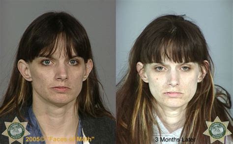 Meth Addicts Before And After 38 Pics