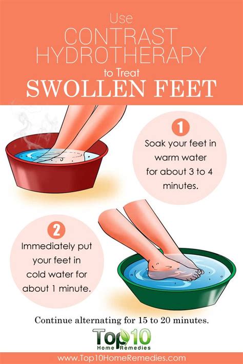 Home Remedies For Swollen Feet Top 10 Home Remedies Foot Remedies
