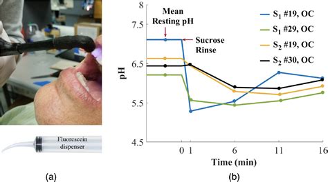 Optical Ph Measurement System Using A Single Fluorescent Dye For Assessing Susceptibility To