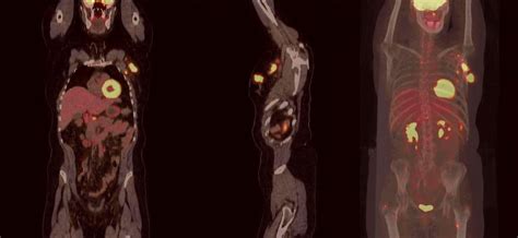 In some cases, physicians use all three imaging techniques. Breast PET scan. Causes, symptoms, treatment Breast PET scan