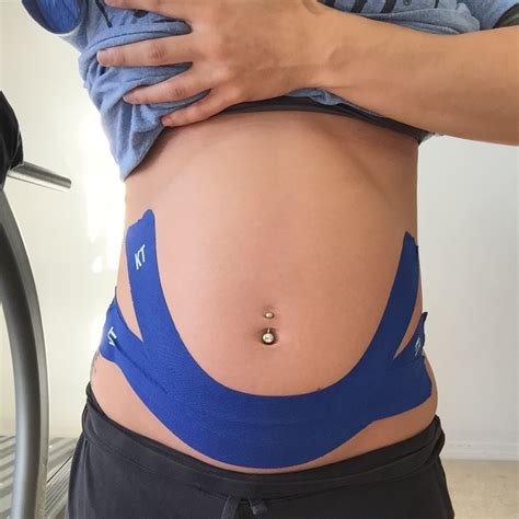 Kinesio Taping During Pregnancy Techniques For The Pregnant Belly Diary Of A Fit Mommy