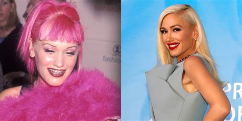 Gwen Stefani Before And After Braces