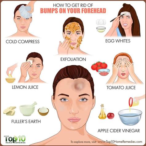 How To Get Rid Of Bumps On Forehead Forehead Bumps Forehead Acne